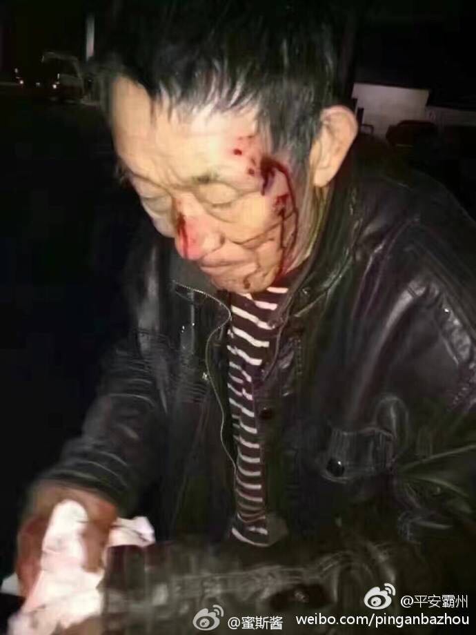 老人在济南汽车站被撞 满脸是血寻家人? 谣言