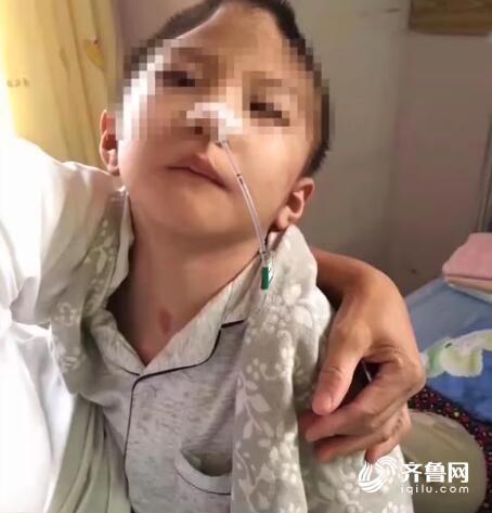 陕西渭南虐童事件调查:6岁童遭继母虐待 头骨