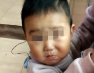寿光2岁的幼儿听不到声音 聋哑人母亲：不愿孩子生活在无声世界中