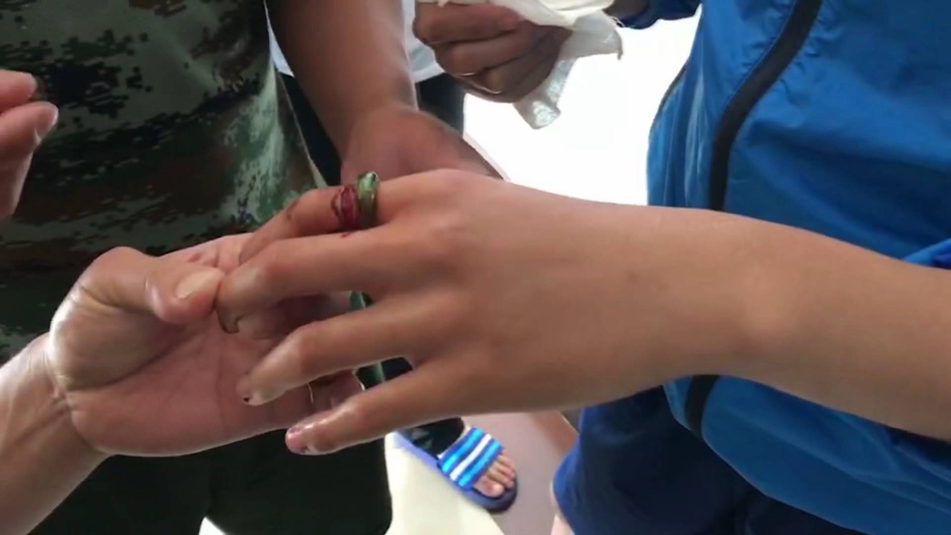45秒丨贪玩！男孩将啤酒瓶瓶嘴当作戒指 手指被卡消防紧急救助