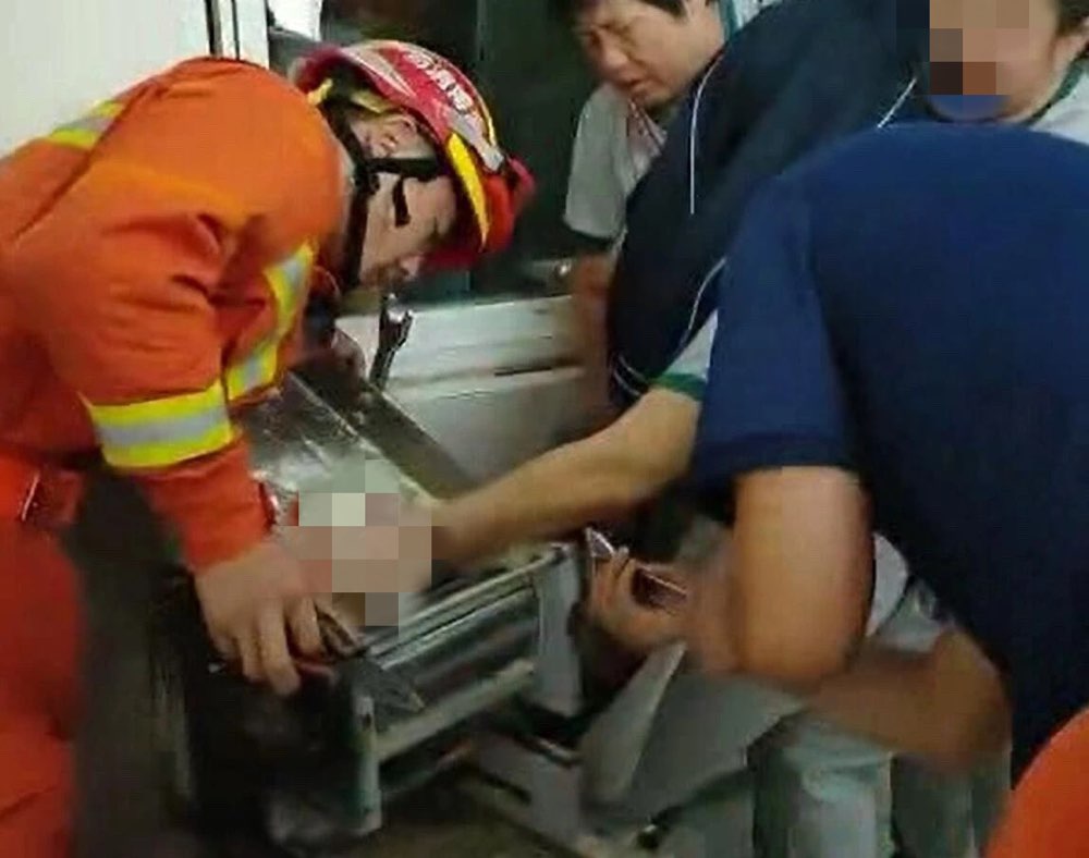 一定要注意安全！淄博一女工左手被卷进压面机