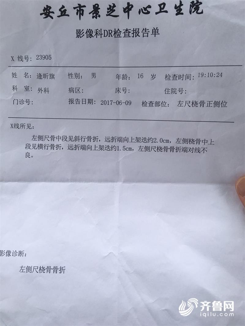 安丘16岁小伙中考前摔断手臂结束v小伙坚持再青椒炒牛腩图片