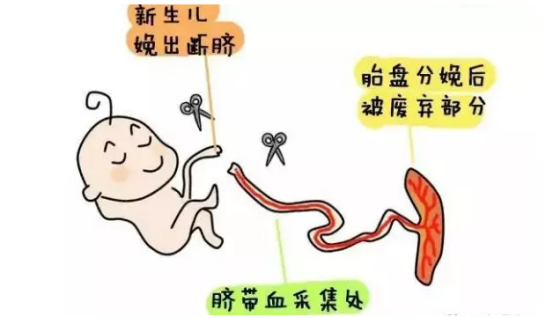 脐带血 是胎儿娩出断脐后 残留在胎盘和脐带中的血液▼