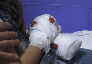 国际象棋机器人折断7岁男孩手指