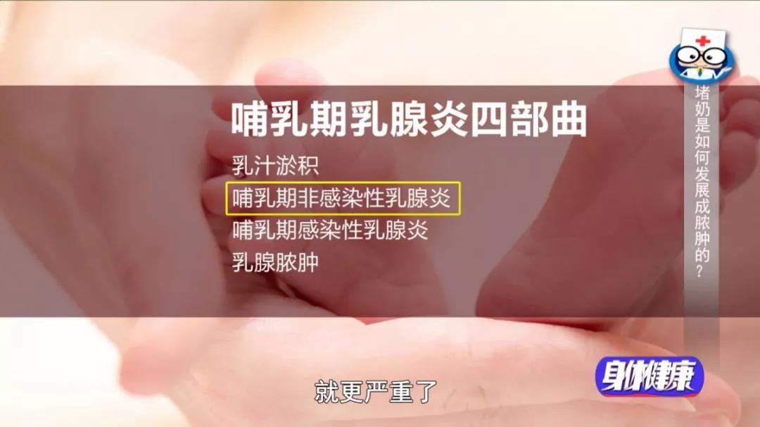 乳汁淤积是急性乳腺炎的 中医推拿是对哺乳期乳房做经络