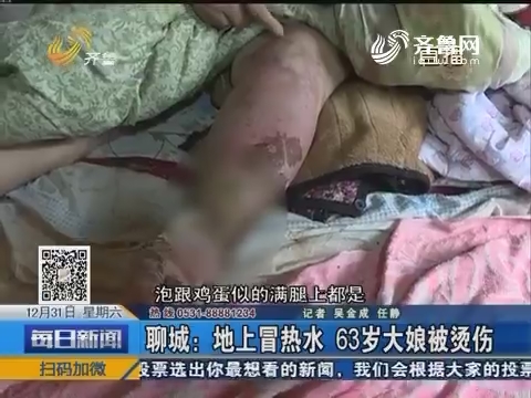 聊城：地上冒热水 63岁大娘被烫伤
