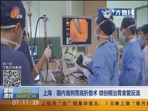上海：国内首例胃底折叠术 微创根治胃食管反流
