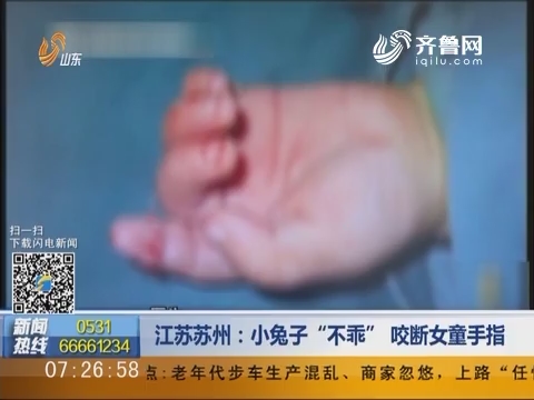 江苏苏州：小兔子“不乖” 咬断女童手指
