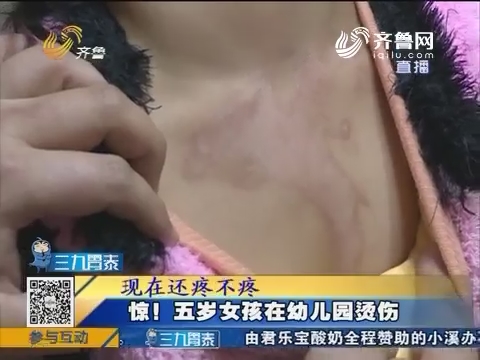 聊城：惊！五岁女孩在幼儿园烫伤