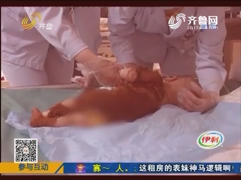 淄博：惨不忍睹 半岁婴儿遭烫伤