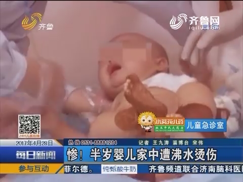 淄博：惨！半岁婴儿家中遭沸水烫伤