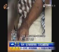 杭州：右手被明虾刺伤 几天后送医急救