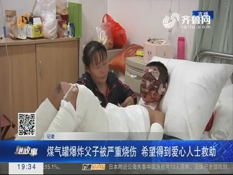【跑政事】潍坊：煤气罐爆炸父子被严重烧伤 希望得到爱心人士救助