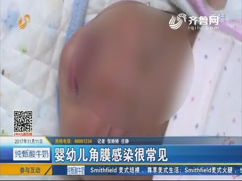 济南：婴幼儿角膜感染很常见