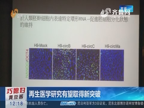 台湾科学家发现多能干细胞“开关”