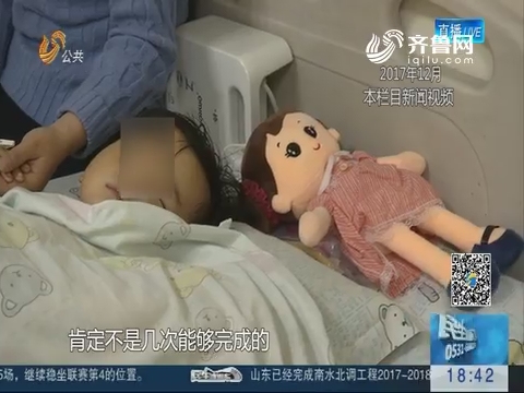 济南：被烫伤的3岁小孩基本痊愈 2月5日出院