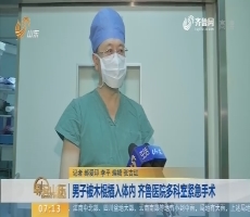 【闪电新闻排行榜】男子被木棍插入体内 齐鲁医院多科室紧急手术