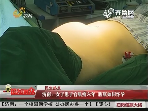 【民生热点】济南：女子患子宫肌瘤六年 腹胀如同怀孕