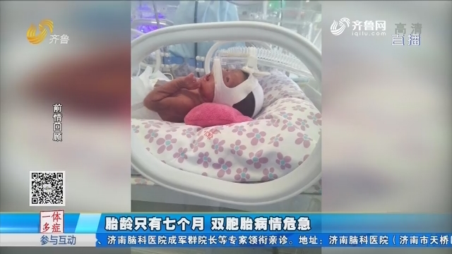 济南：胎龄只有七个月 双胞胎病情危急