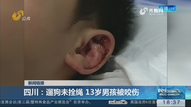 【新闻链接】四川：遛狗未拴绳 13岁男孩被咬伤