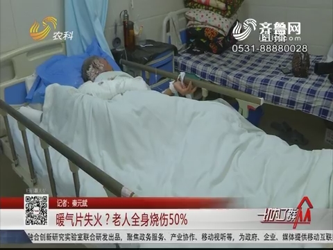 济南：暖气片失火？老人全身烧伤50%
