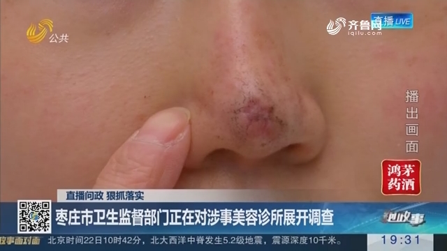 【直播问政 狠抓落实】枣庄市卫生监督部门正在对涉事美容诊所展开调查