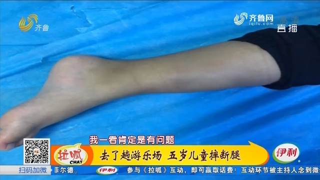 潍坊：去了趟游乐场 五岁儿童摔断腿