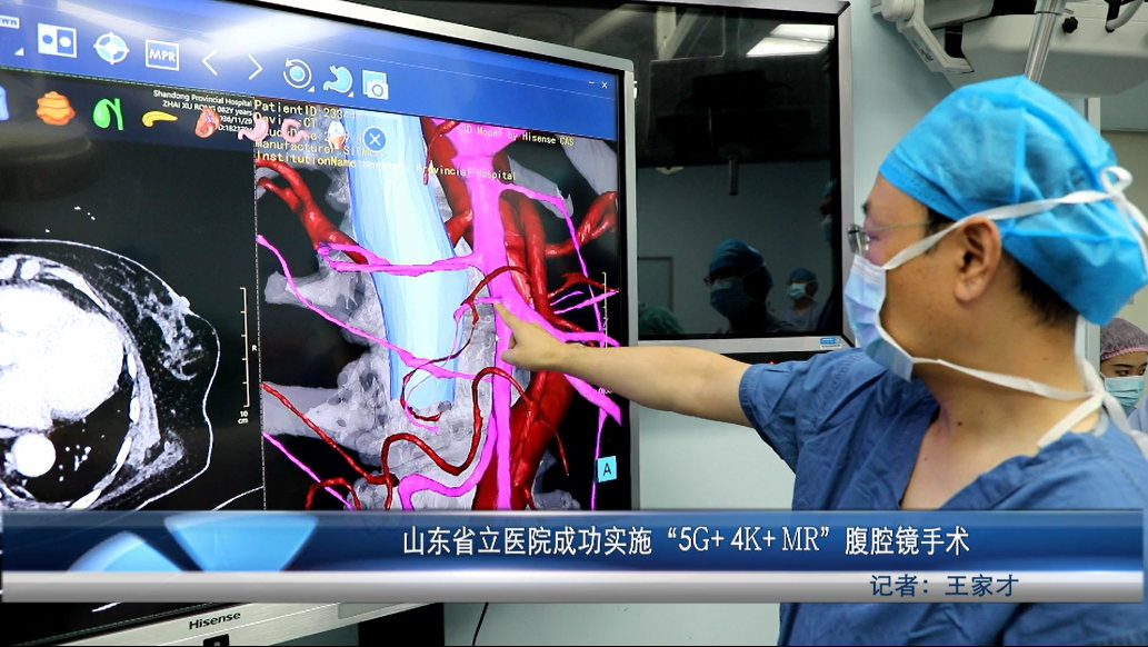 国内首秀！山东省立医院成功实施“5G+4K+MR”腹腔镜手术