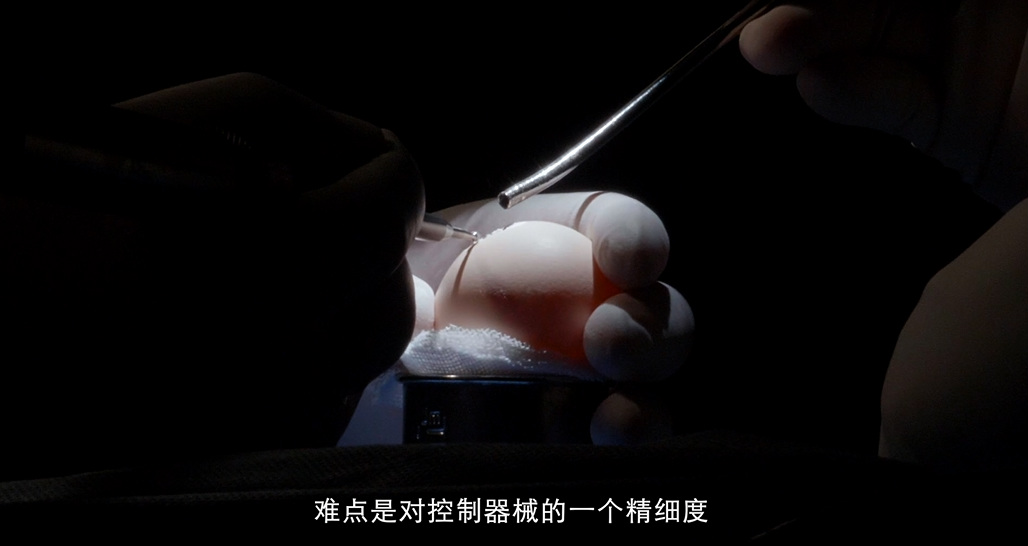 医生们的“逆天神技”——在鸡蛋壳上玩“”雕刻” 为鸡蛋内膜做“缝合”