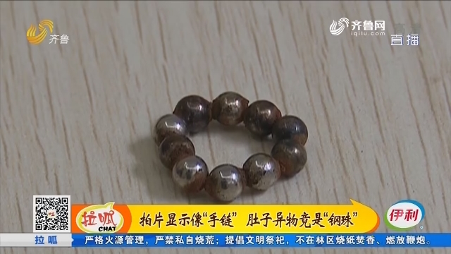 淄博：拍片显示像“手链” 肚子异物竟是“钢珠”