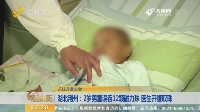 【闪电新闻排行榜】关注儿童安全——湖北荆州：2岁男童误吞12颗磁力珠 医生开腹取珠