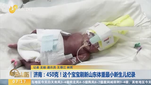 济南：450克！这个宝宝刷新山东体重最小新生儿纪录