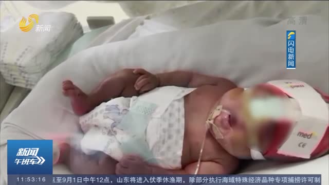 【生命奇迹】济南：450克！这个宝宝刷新山东体重最小新生儿纪录