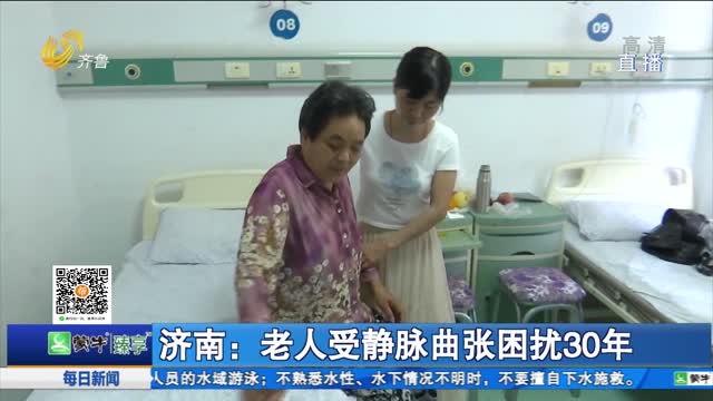济南：老人受静脉曲张困扰30年