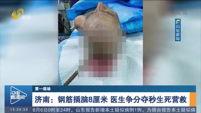 济南：钢筋插脑8厘米 医生争分夺秒生死营救