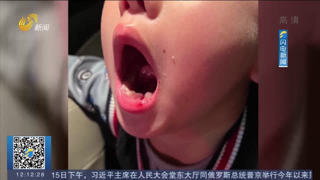 【闪电热播榜】广西一6岁儿童学琴被打掉牙 培训老师称正常教学