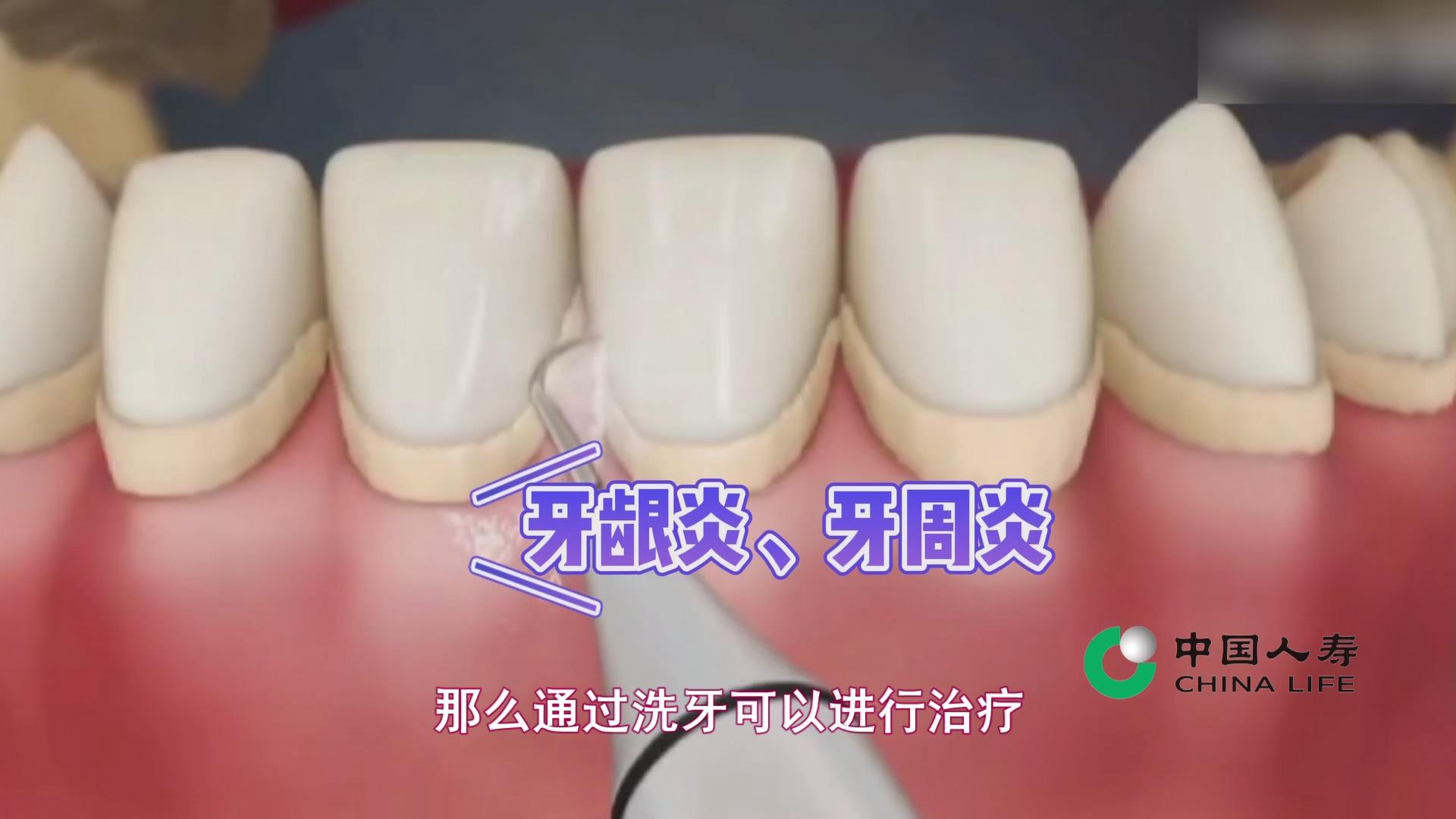 中國式養老-中老年如何養護牙齒