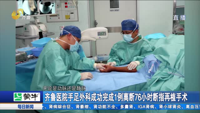 齐鲁医院手足外科成功完成1例离断76小时断指再植手术