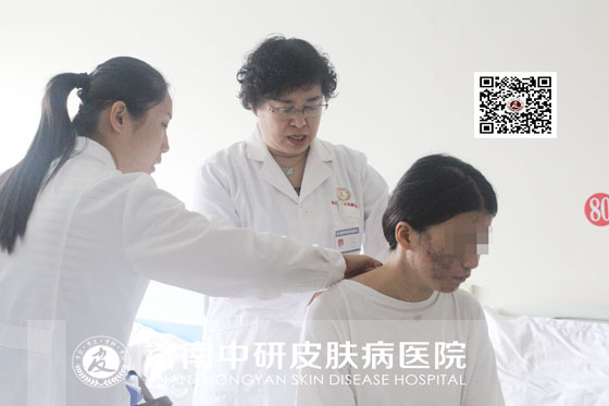 舞蹈系女孩因脓包型痤疮患抑郁症 前程灰暗满是忧愁