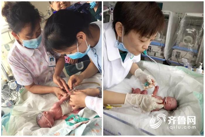茌平一产妇伏天厕所产子 医护人员火速救治母子平安
