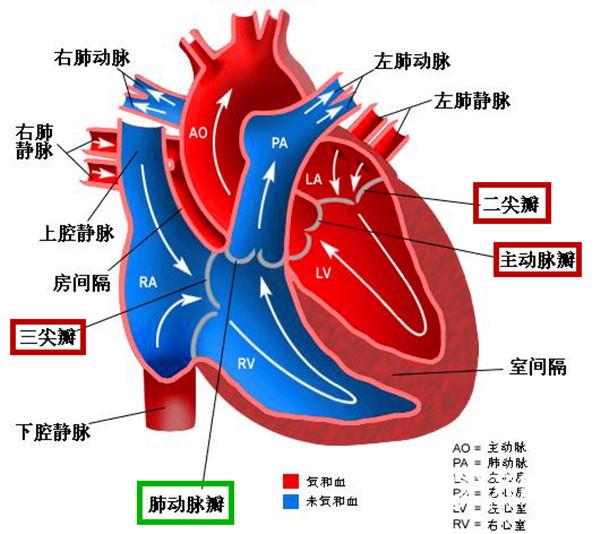 如图所示,吴女士的4个心脏瓣膜中有3个出现了关闭不全的情况