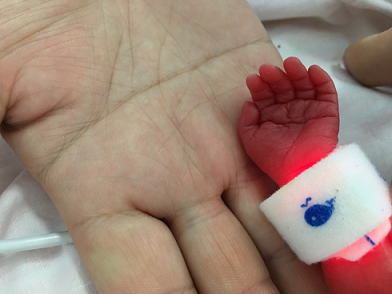 捧在手心里长大的巴掌婴儿