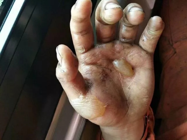 泪目那只被15万人点赞的手终于找到了