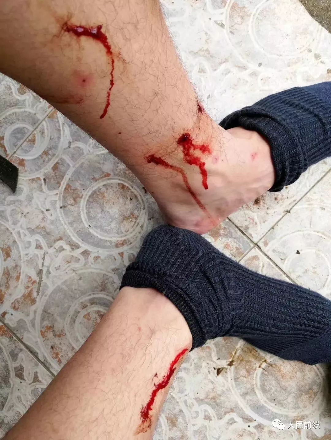 "突袭"他们训练有素巡逻路上的各个角落这些"吸血鬼"潜伏在旱蚂蟥,水