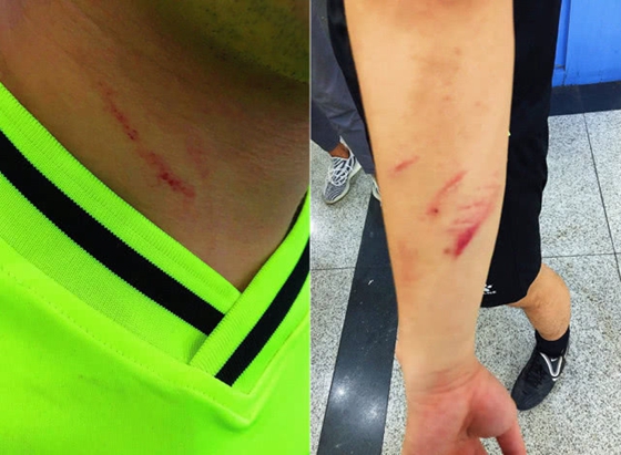 追打飞踹曝成都业余联赛裁判遭围殴全身多处受伤脑震荡