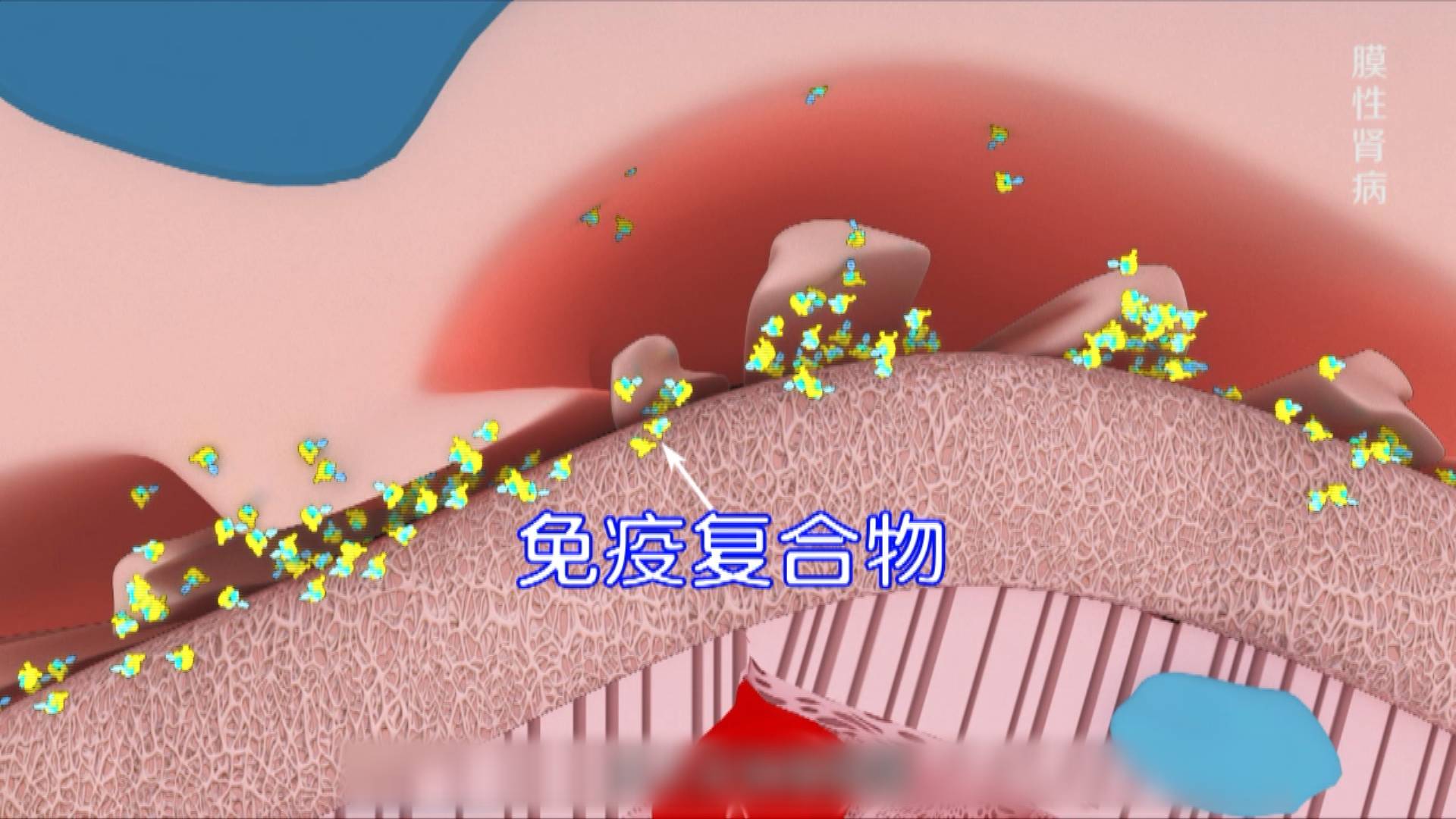 身体健康丨脚肿到鞋都穿不下原来是肾脏出了问题