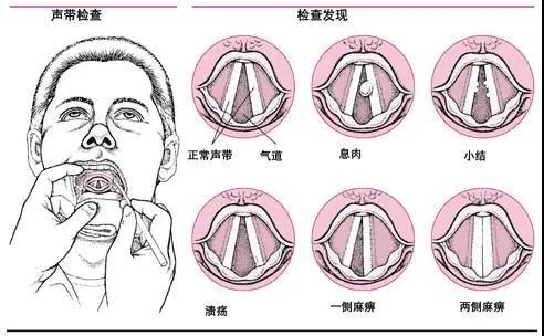 93b212435c7660e4e02644199704a33e.jpg 微信图片_20200416091323.jpg