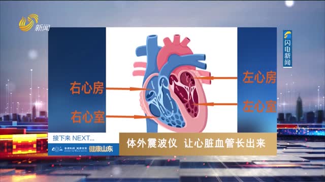 20250509《健康山东》：体外震波仪 让心脏血管长出来