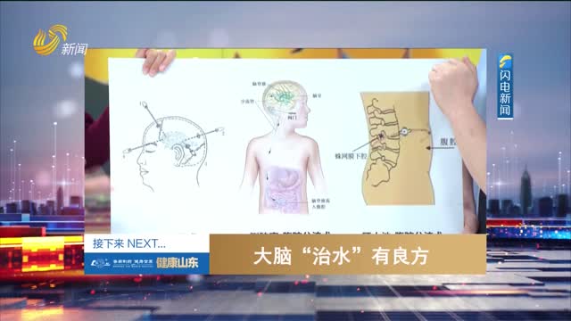 20250515《健康山东》：大脑“治水”有良方