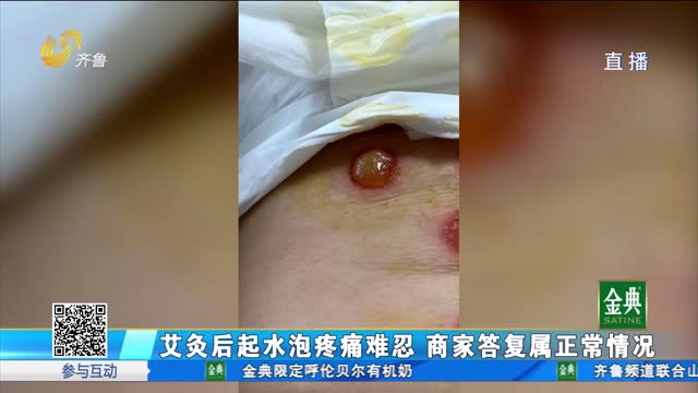 艾灸后起水泡疼痛難忍 商家答復(fù)：正?，F(xiàn)象